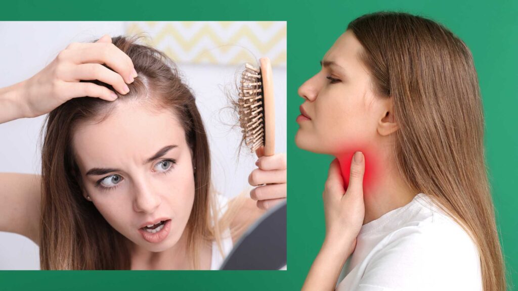 Thyroid Cause Hair Loss Understand and Find the Solutions